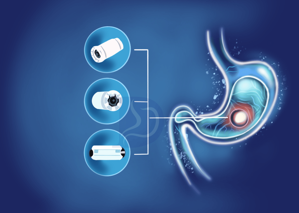 Capsule Endoscopy Nashville Digestive And Liver Health Specialists