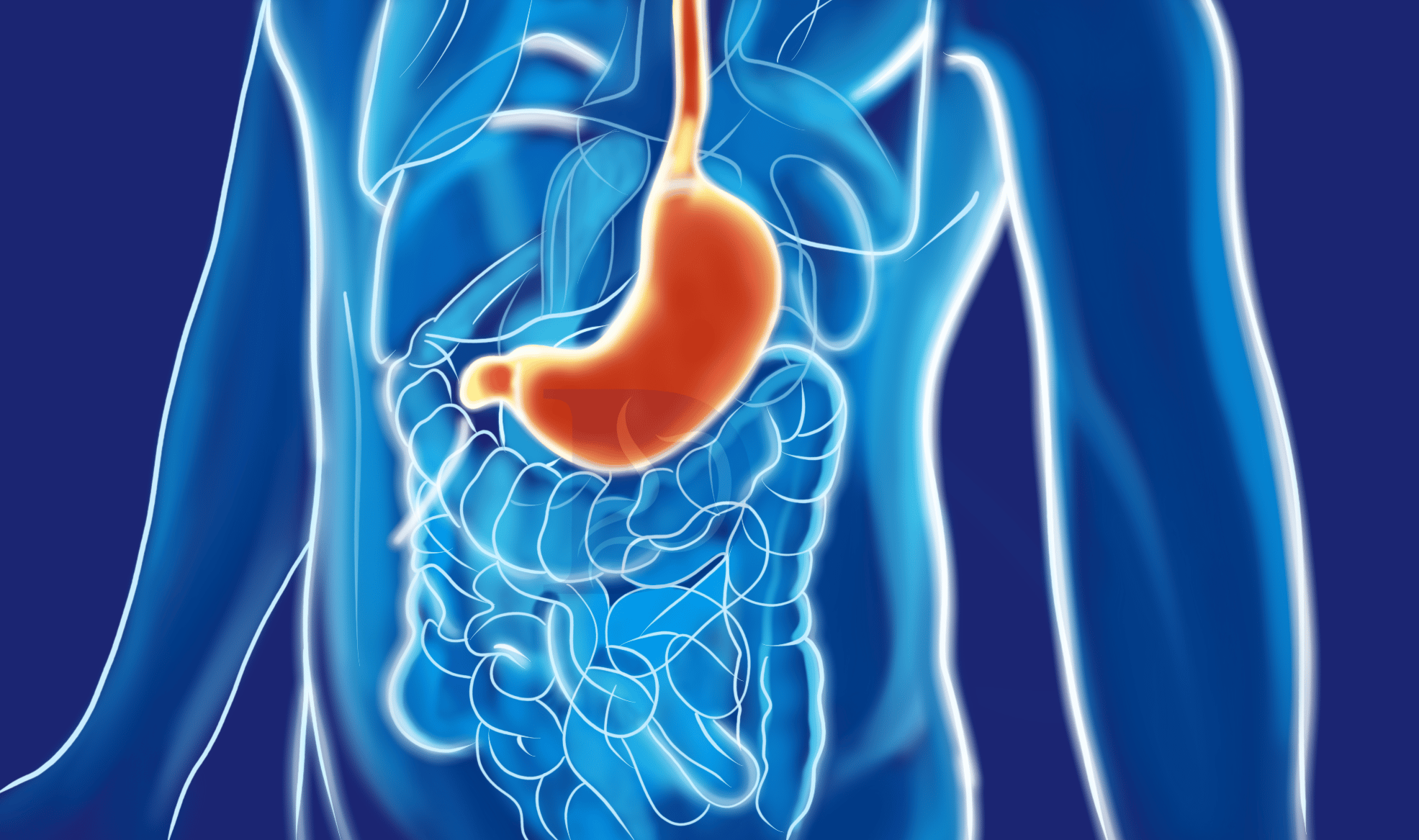 H Pylori Treatments For Optimal Digestive Health The GI Docs