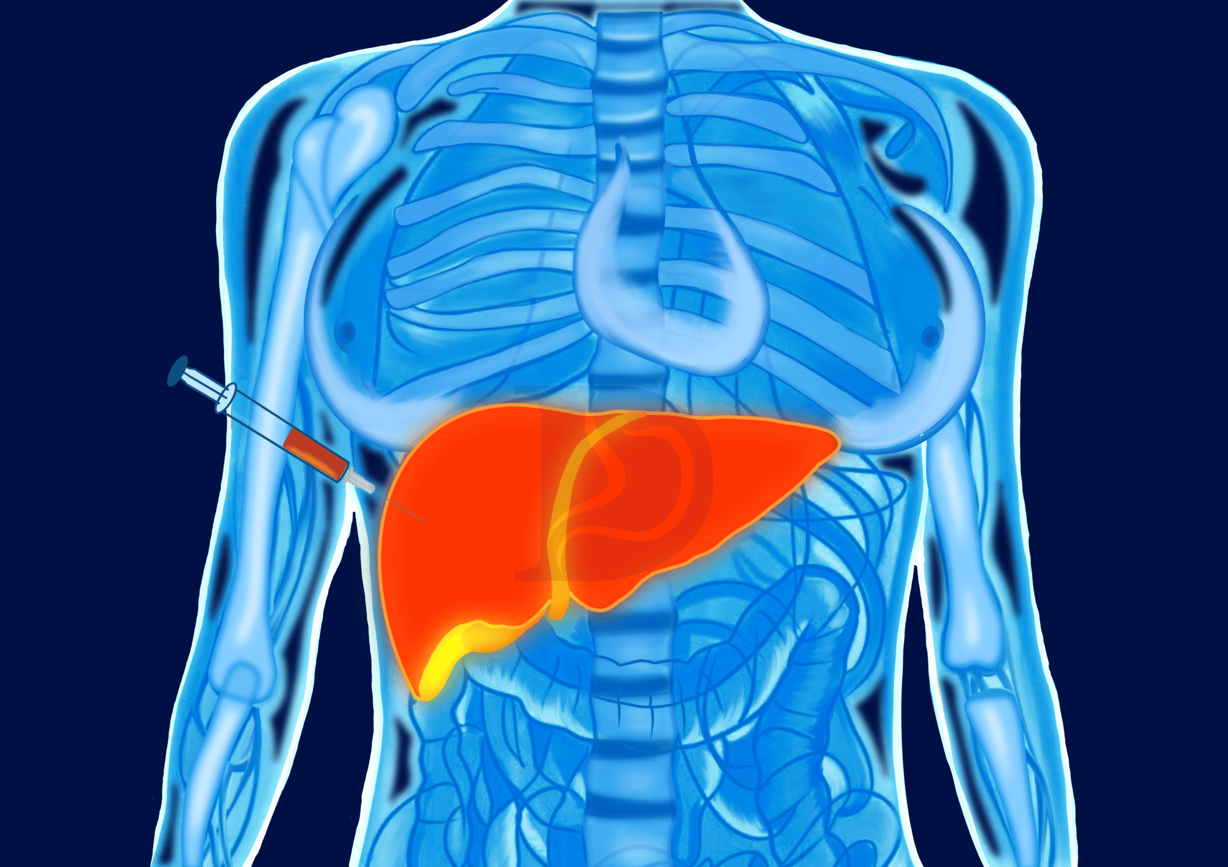 Liver biopsy