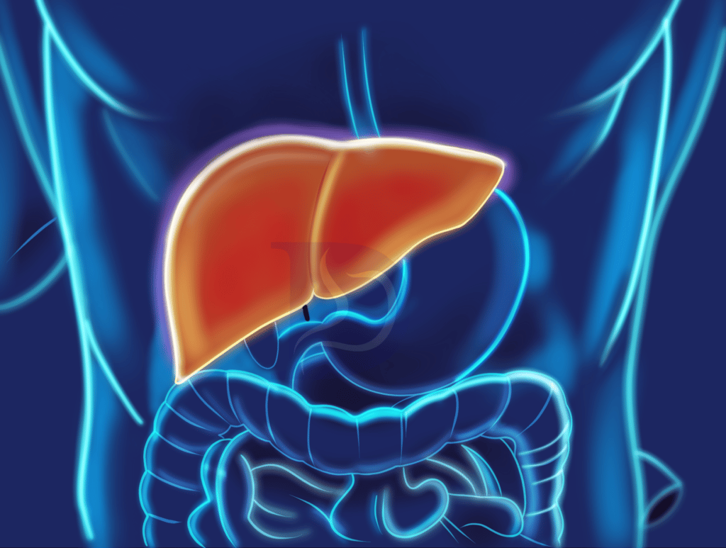 Fatty Liver Disease Life Expectancy and Treatment - The GI Docs