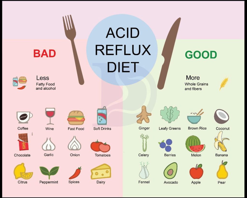 Gastroesophageal Reflux Disease Diet - Digestive and Liver Health ...