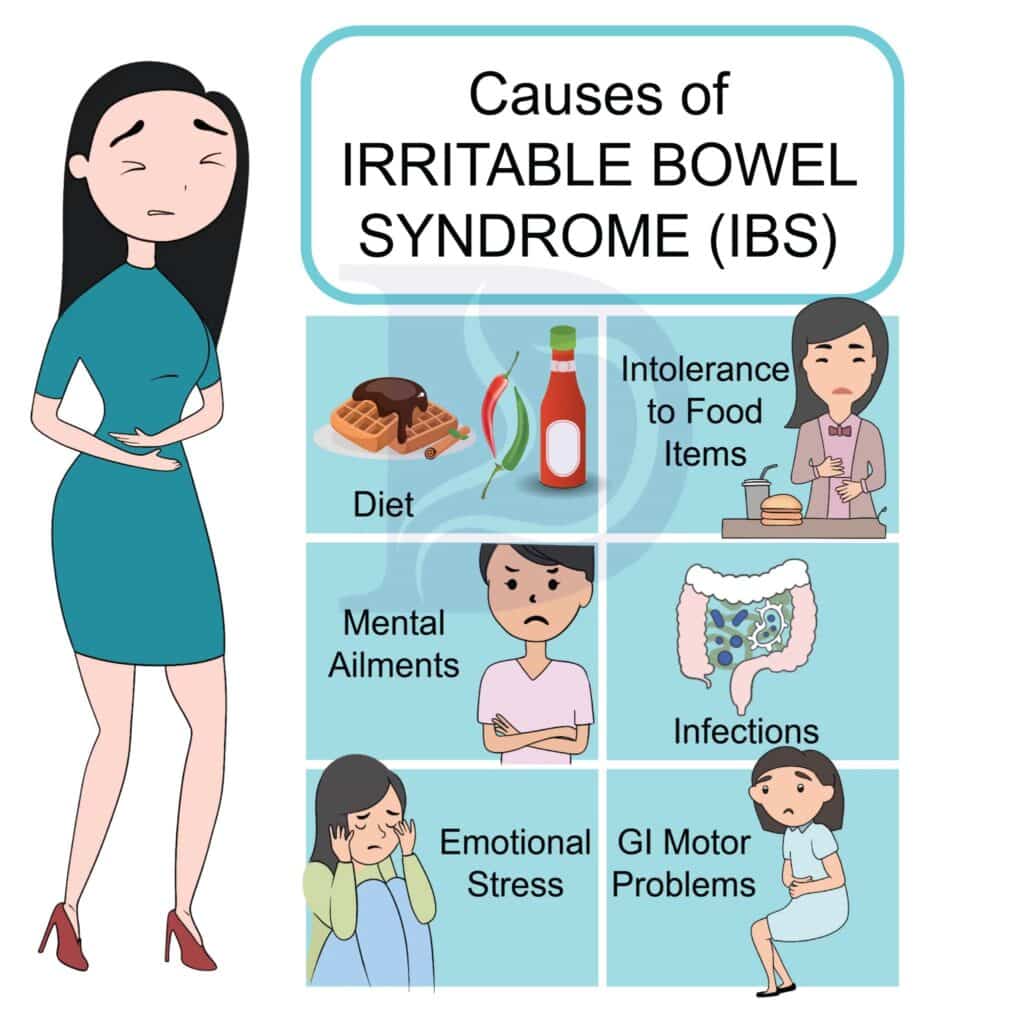 Managing Irritable Bowel Syndrome - Digestive And Liver Health Specialists